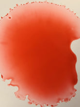 Load image into Gallery viewer, Brain Hemorrhage