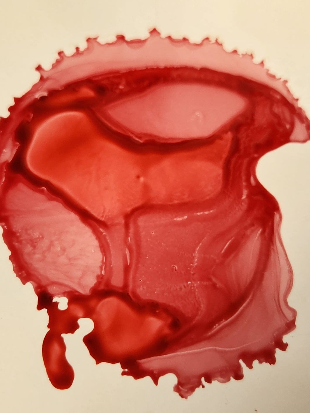 Brain Hemorrhage